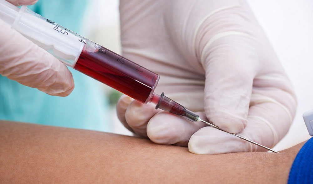 Blood Collection Services