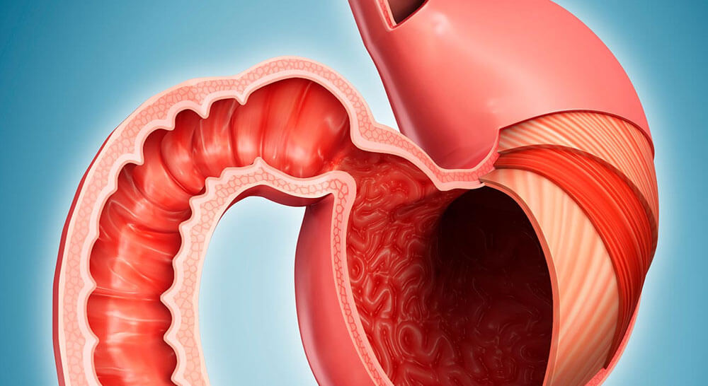 Gastrointestinal Surgery