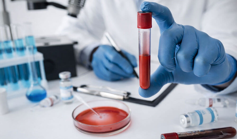 All Routine Blood Tests